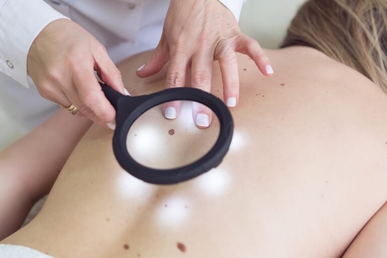 Carcinoma de células escamosas “in situ”: entenda câncer de Bolsonaro