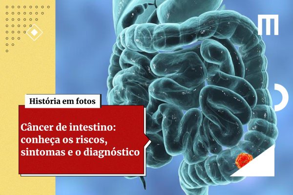 Exame de fezes pode detectar 90% dos cânceres de intestino, diz estudo