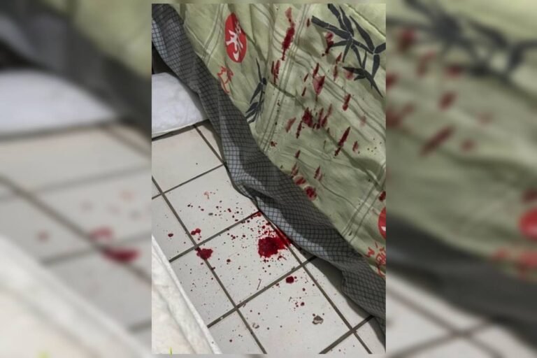Filho espancado pelo pai suja quarto de sangue na Asa Norte