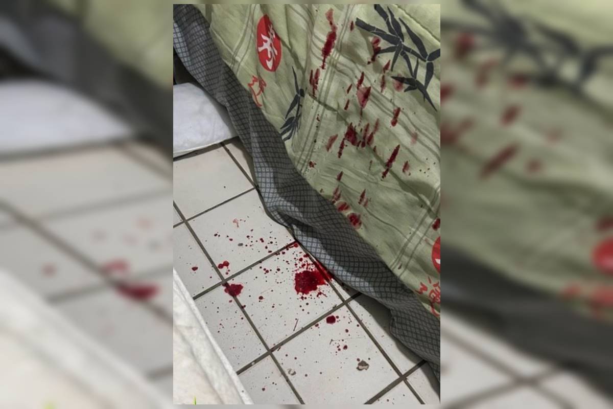 Filho espancado pelo pai suja quarto de sangue na Asa Norte