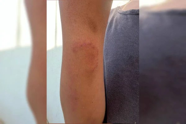 Mãe que torturava filho de 14 anos obrigava irmã dele a se prostituir