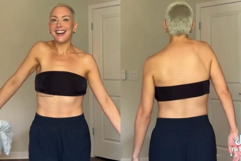 Mulher relata mudança misteriosa em seu ombro: “Levantando sozinho”