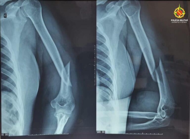 Carroceiro é preso após espancar e torturar mulher durante 6 horas no DF