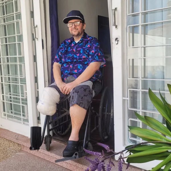 Por que David Castilho, de A Praça É Nossa, teve de amputar a perna?