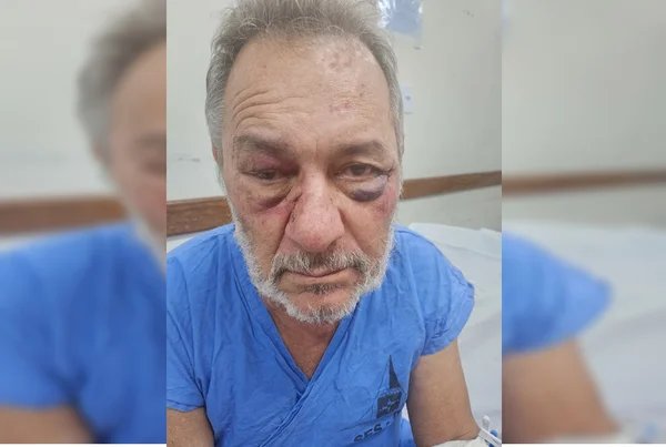 Vídeo: motorista se irrita após batida e espanca homem de 68 anos no DF