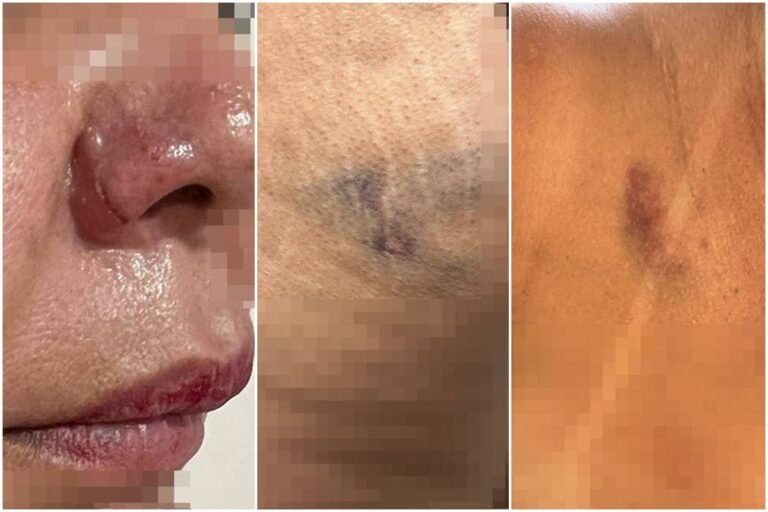 homem é preso após agredir mulher