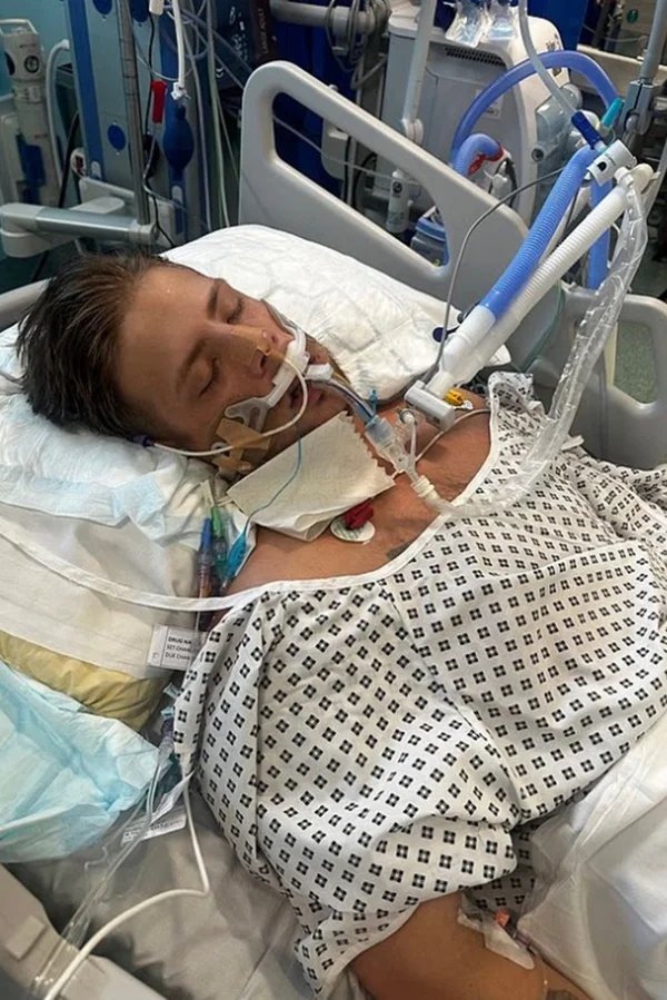 AVC: jovem entra em coma após ter sintomas confundidos com embriaguez