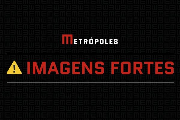 Mulher que teve seios necrosados denuncia médico do DF por erro