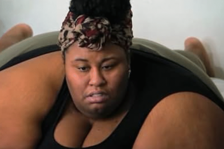 participante de 314 kg choca com antes e depois