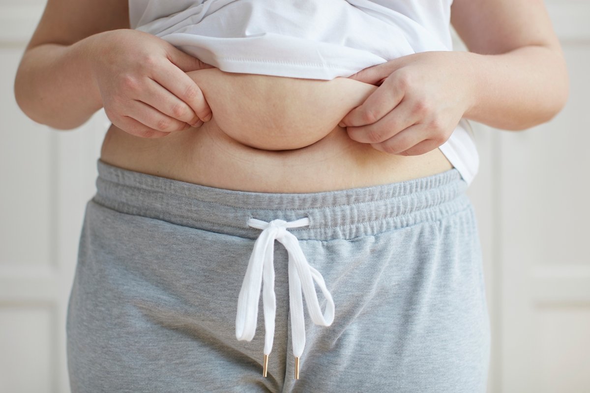 "Barriga de chope" pode sinalizar risco cardíaco precoce, diz estudo