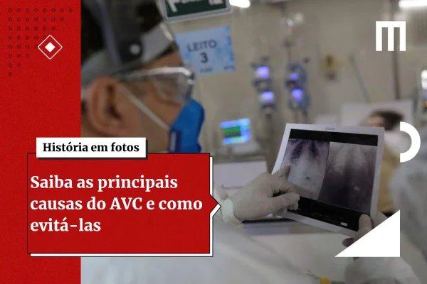 Cardiologista ensina como saber se você está tendo um AVC
