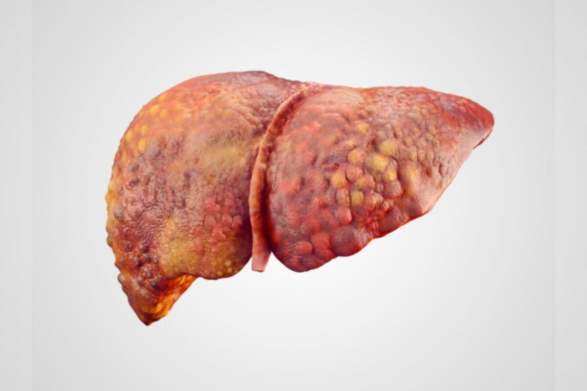 estudo explica desenvolvimento em pessoas magras