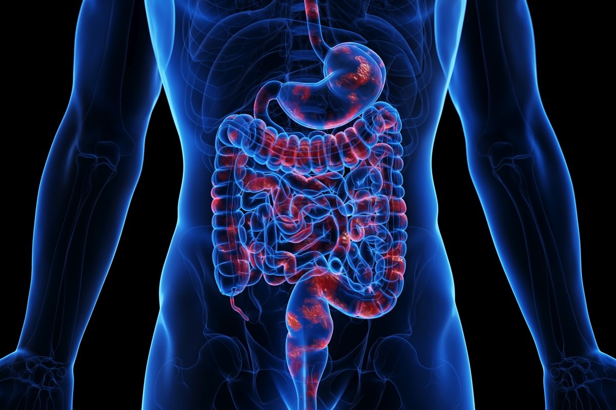 Médico ensina como identificar inflamação ligada à síndrome metabólica