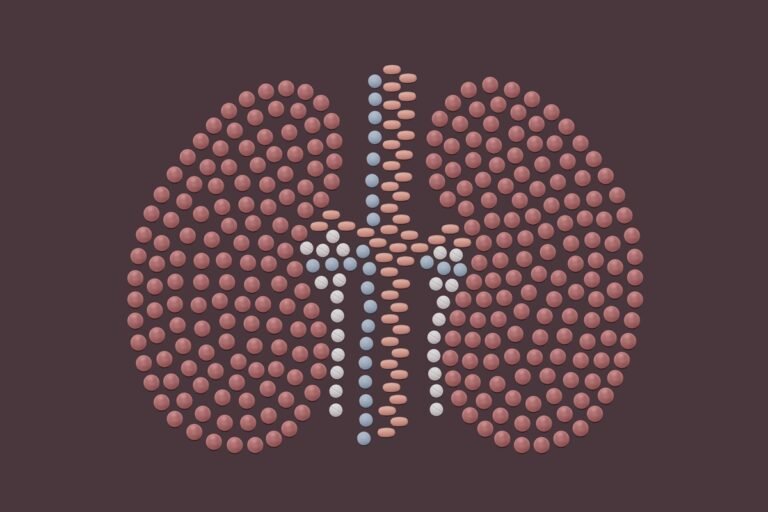 Remédio usado para artrite pode melhorar rins doados para transplante