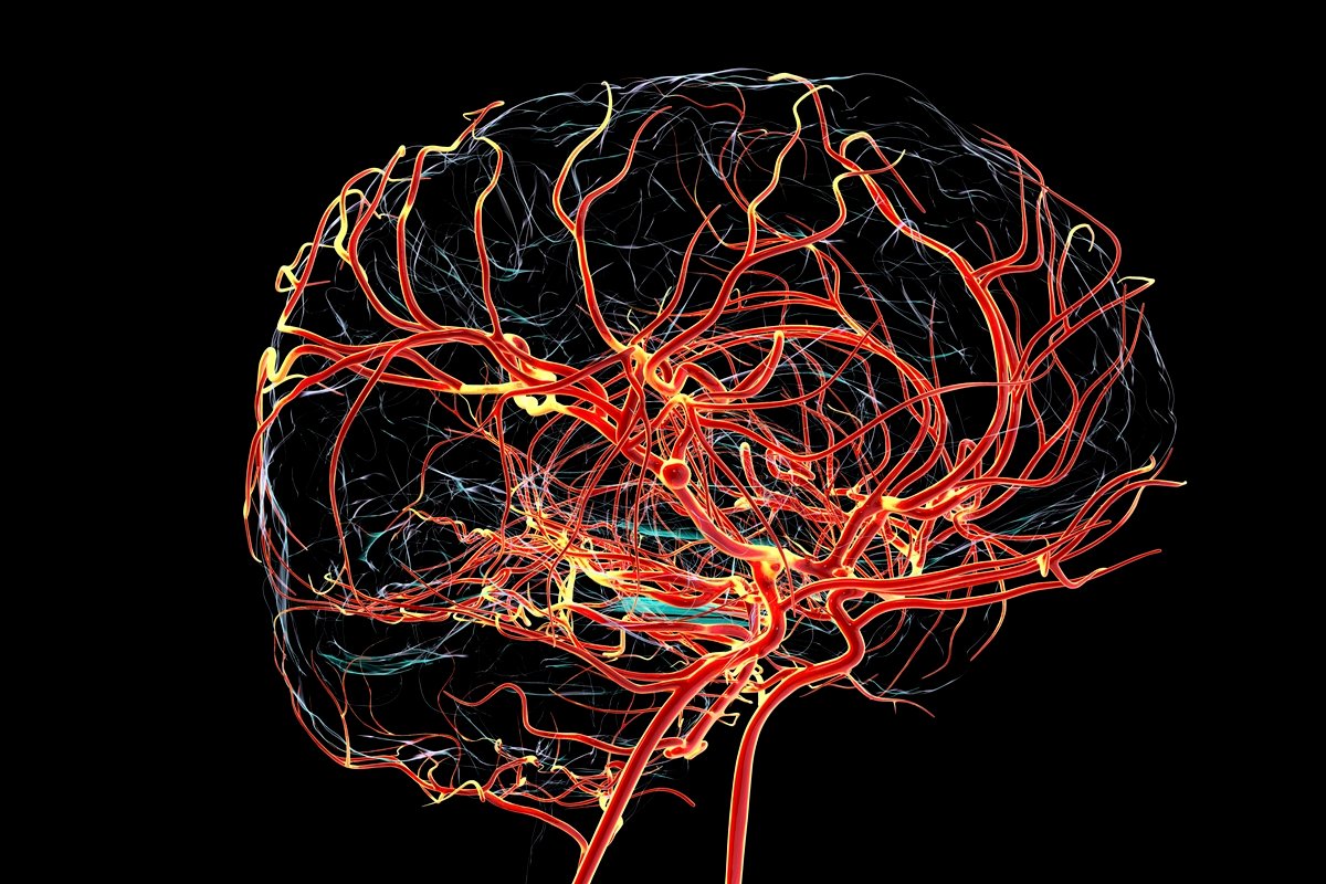 Alzheimer pode começar com a queda do fluxo sanguíneo, sugere estudo