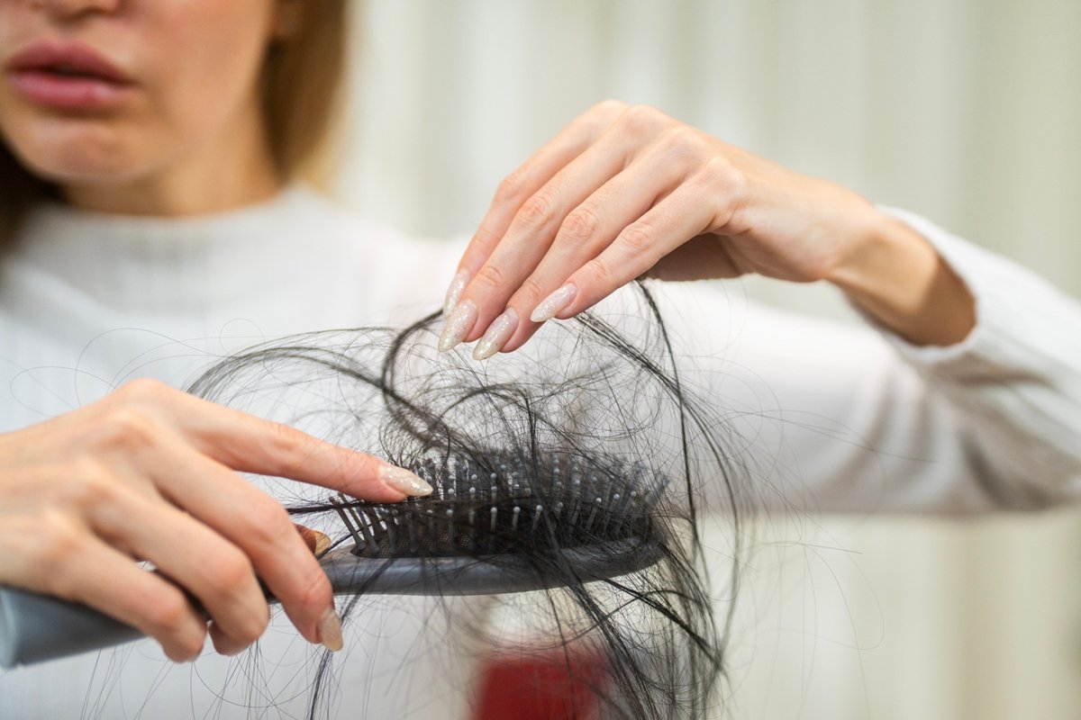 Dermatologista conta 5 sinais de alerta de que a queda de cabelo é séria