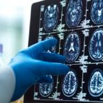 Geriatra lista 5 melhores hábitos que podem reduzir risco de Alzheimer