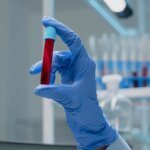 Estudo brasileiro cria exame de sangue para detectar câncer de mama