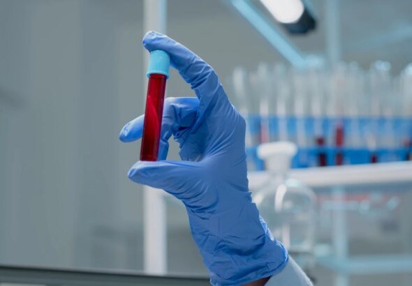 Estudo brasileiro cria exame de sangue para detectar câncer de mama