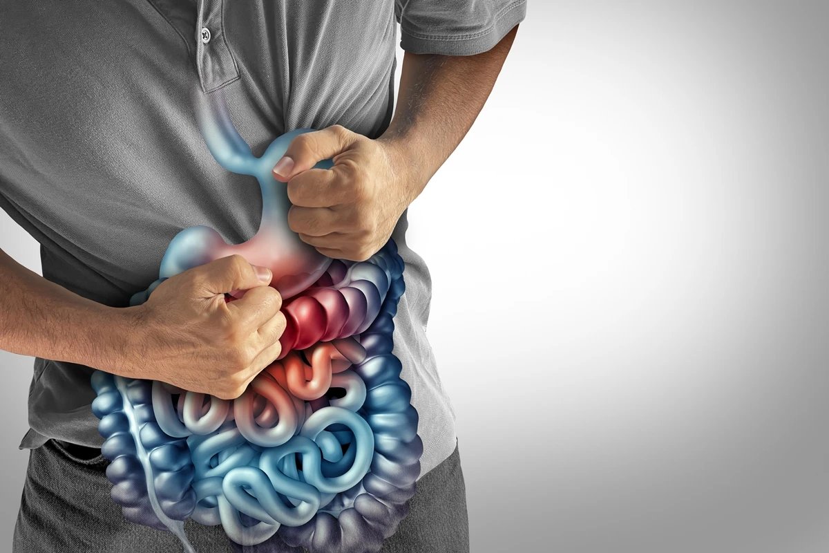 Estudo revela células que impulsionam fibrose na doença de Crohn
