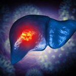 Estudo sugere que comer menos proteína pode atrasar o câncer de fígado