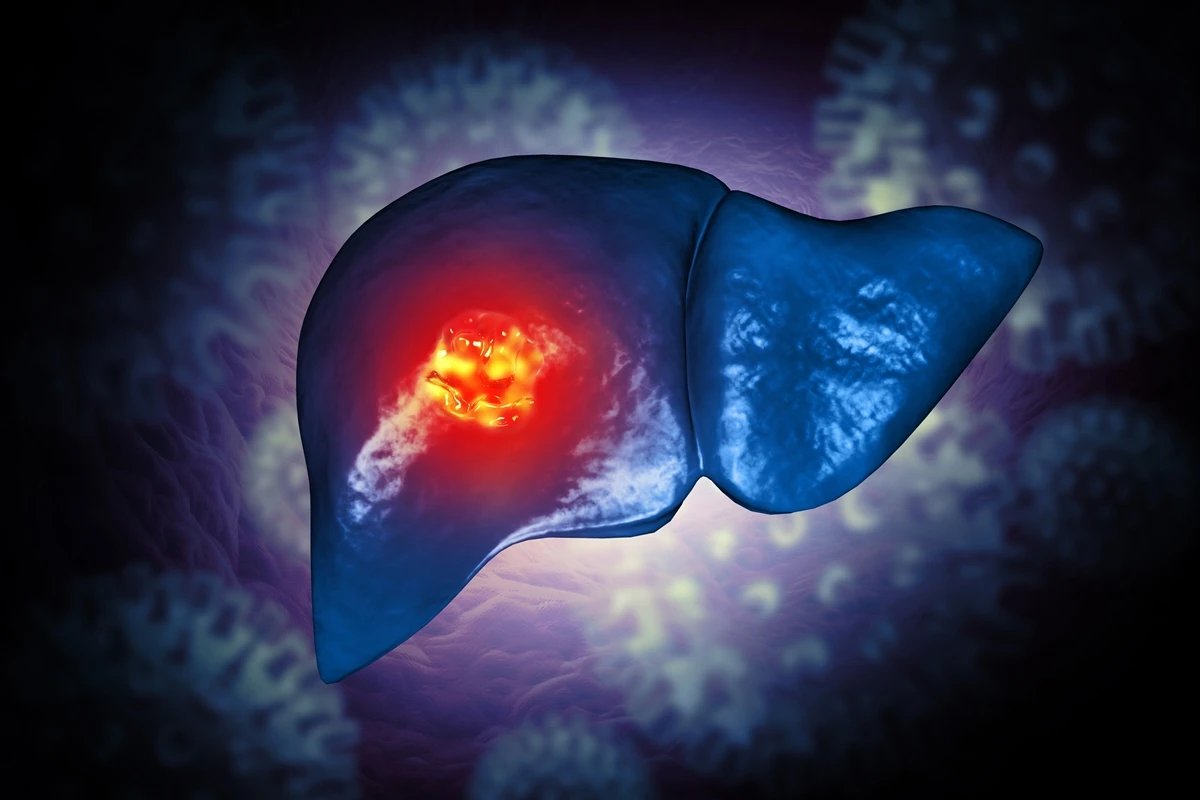 Estudo sugere que comer menos proteína pode atrasar o câncer de fígado