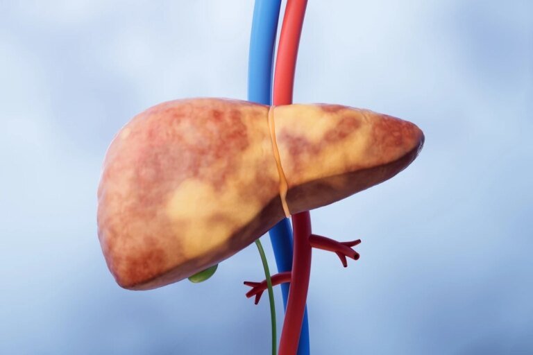 Geneticista alerta para sintomas do câncer de fígado