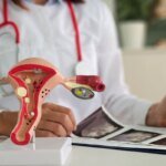 por que é importante ir ao ginecologista