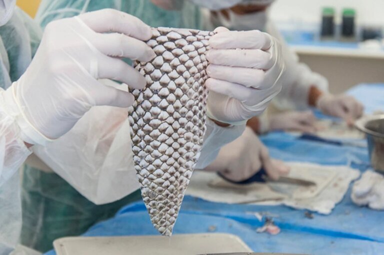 técnica com pele de tilápia vai além de queimaduras