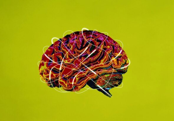 7 síndromes associadas ao Alzheimer que vão além da perda de memória