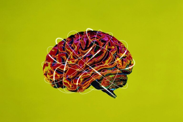 7 síndromes associadas ao Alzheimer que vão além da perda de memória