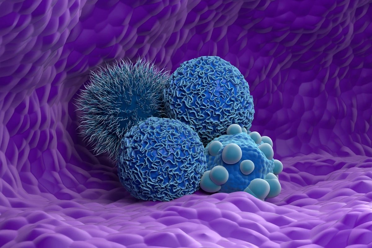 Estudo liga gordura da dieta a maior agressividade no câncer de mama