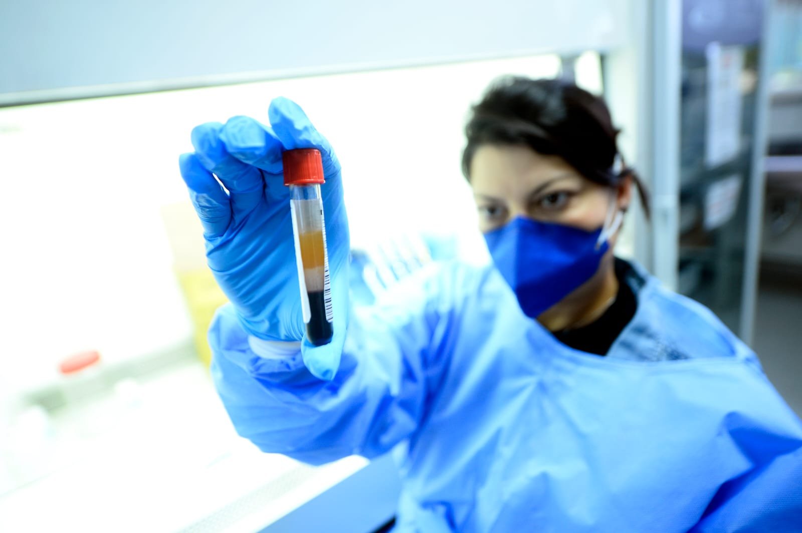 Exames de alta precisão chegam à rede pública do DF e mudam rotina de atendimentos