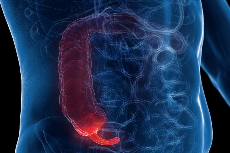 Gastro explica como reconhecer os principais sintomas da apendicite
