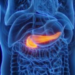 Genes ligam obesidade e diabetes a câncer de pâncreas