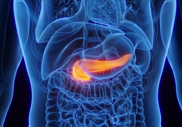 Genes ligam obesidade e diabetes a câncer de pâncreas
