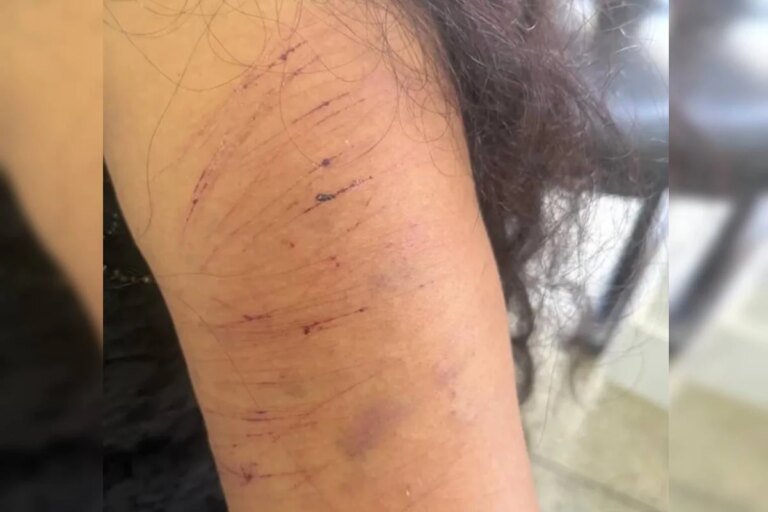 Mulher é atacada pelo ex no meio da rua a caminho de consulta com psicólogo