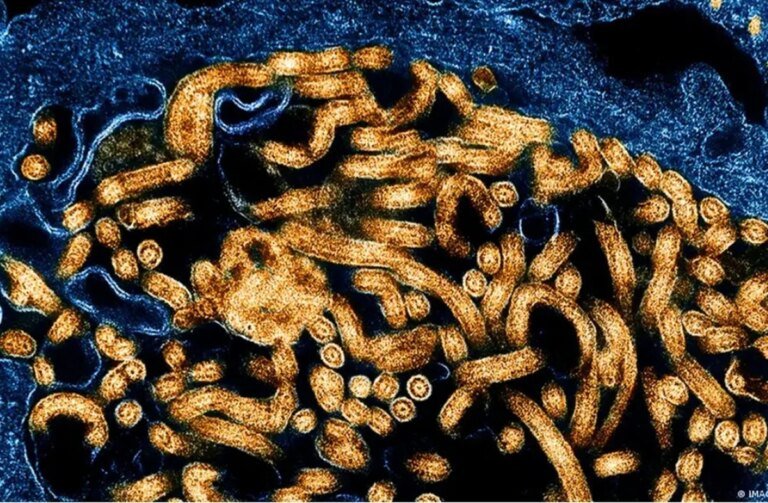 OMS avalia risco de ebola como alto no Congo, mas baixo globalmente