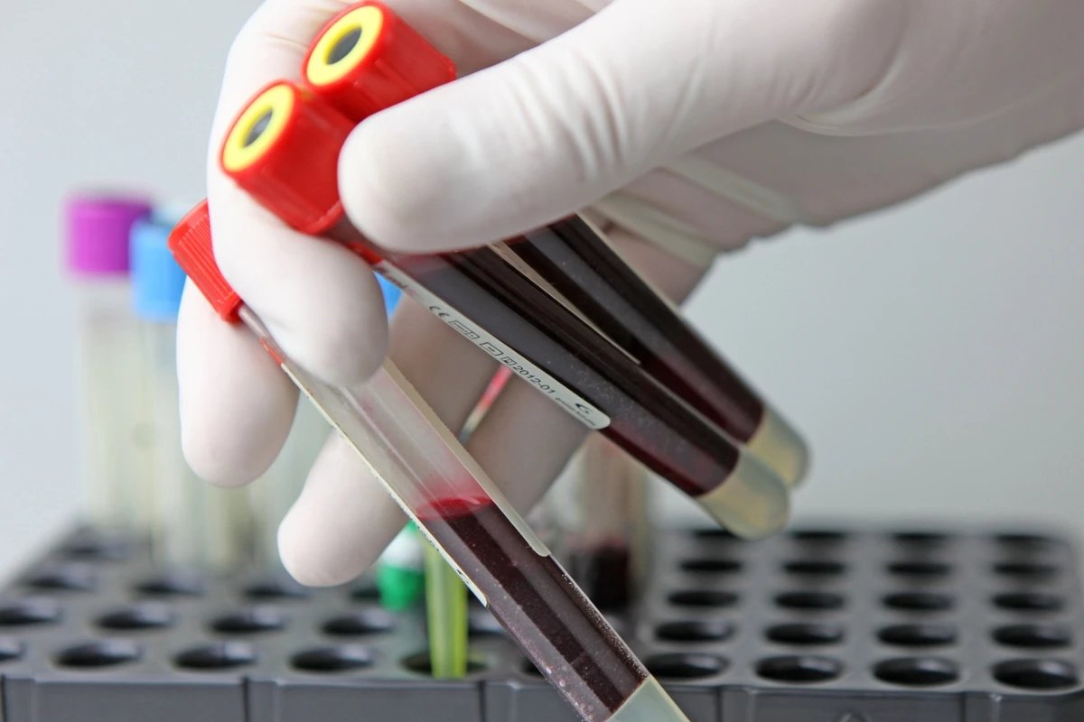 Seu sangue pode revelar doenças antes dos sintomas? Descubra