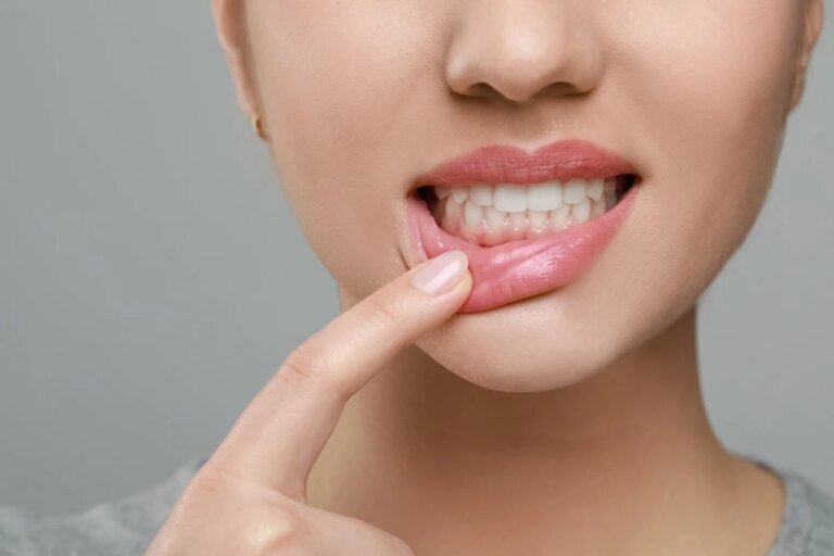 Entenda por que no inverno os dentes podem ficar mais sensíveis